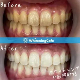 メンズ キッズ ホワイトニング カフェ志木店のエステ・リラクイメージ