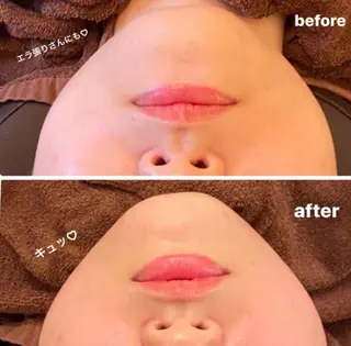 ■超絶小顔&肌管理室■所属・🦋整形級の究極美顔 本格韓国式小顔🦋のエステ・リラクイメージ