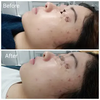 肌質改善Beauty salon Renのエステ・リラクイメージ