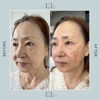 Melty eye beauty salon所属・平岡 みづきのマツエク・マツパデザイン