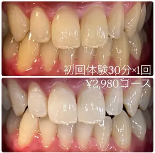 PLATINUM Beauty 横浜店所属・ホワイトニングルーム 横浜店のその他イメージ