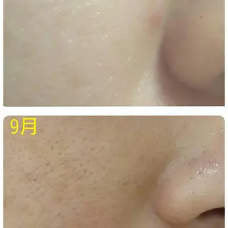 野口 晶子のエステ・リラクイメージ