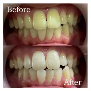 LBSホワイトニング 🌐岡山店のその他イメージ