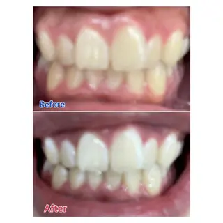 MBEAUTYSALON 千葉店・京成大久保所属・Melty 輝のその他イメージ