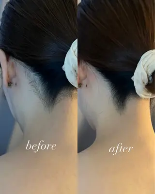 うなじ脱毛/美肌脱毛 LABELのエステ・リラクイメージ