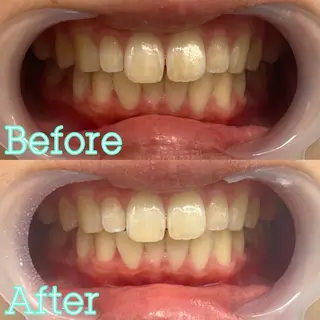 歯のホワイトニング専門店 MIGAQ 京都四条大宮店所属・佐藤 未来の眉毛・アイブロウイメージ