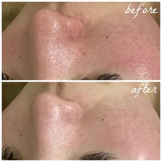 メンズ メナード岐阜茜部 杉浦のエステ・リラクイメージ