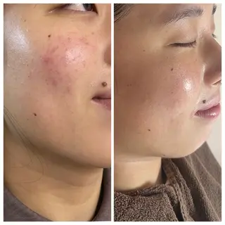 shaving room 晴のエステ・リラクイメージ