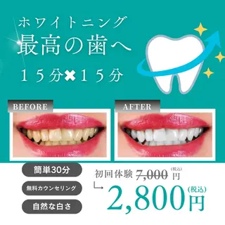 メンズ soerute所属・オーラルケアサロン soeruteのその他イメージ