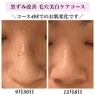 Bellesthe (ベルエステ)のエステ・リラクイメージ