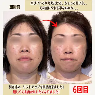 経堂鍼灸整体院 古木のエステ・リラクイメージ