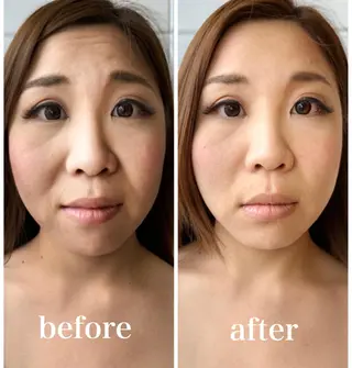 美容鍼 IKEZAKIのエステ・リラクイメージ