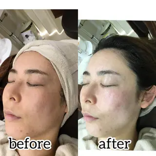 laluna saki...のその他イメージ