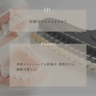 キッズ ホワイトニングサロン Ecru所属・ホワイトニングサロン Ecru エクリュのその他イメージ