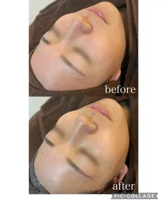 肌質改善|美眉サロンCannone'所属・肌質改善|美眉サロン Cannone’のエステ・リラクイメージ