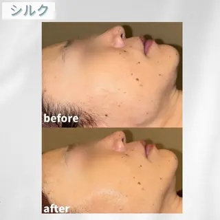 🫧ビュースタ 伊藤🫧のエステ・リラクイメージ