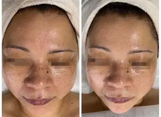 De I'm トータルビューティーサロン所属・COCO beautyサロンのエステ・リラクイメージ