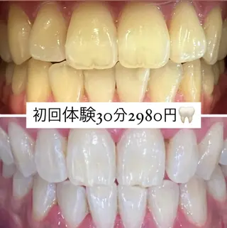 PLATINUM Beauty 横浜店所属・ホワイトニングルーム 横浜店のその他イメージ