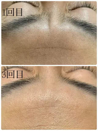 自宅サロン Roiのマツエク・マツパデザイン