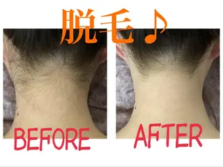 Prima〜プリマ〜 名古屋駅店所属・Prima 痩身脱毛 にごうかおりのエステ・リラクイメージ