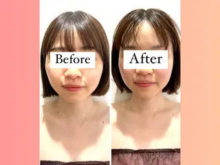 痩身&小顔矯正専門店 Re:Livesのその他イメージ