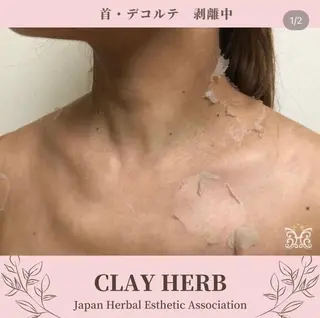 【剥離ありハーブピーリング専門エステ】cerisier BEAUTÉ 原宿所属・cerisier BEAUTÉのエステ・リラクイメージ