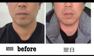 小顔と ヘッドスパのお店のエステ・リラクイメージ