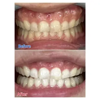 MBEAUTYSALON 千葉店・京成大久保所属・Melty 輝のその他イメージ