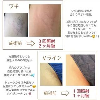 シミケアサロン REVIASオーナーのエステ・リラクイメージ