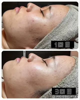 エステ✖️ネイル Feelのネイルデザイン