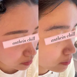 アイブロウ アンテインチル 山本のエステ・リラクイメージ