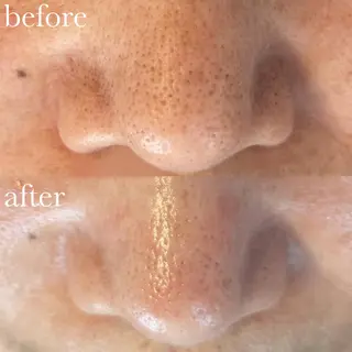 Luana アイラッシュ& フェイシャル所属・Luana eyelashのマツエク・マツパデザイン