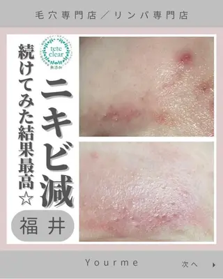 毛穴ケア専門サロン Yourmeユアミーのエステ・リラクイメージ