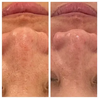 ANERA Second所属・尾上 沙織のエステ・リラクイメージ