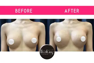 エルフラージュ 銀座店のエステ・リラクイメージ