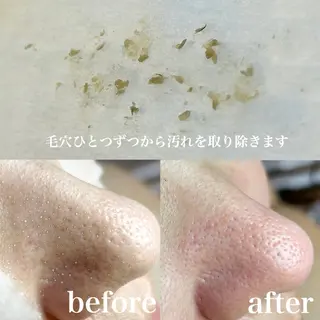 美肌脱毛&毛穴専門 Nico🐰ྀི♡のエステ・リラクイメージ