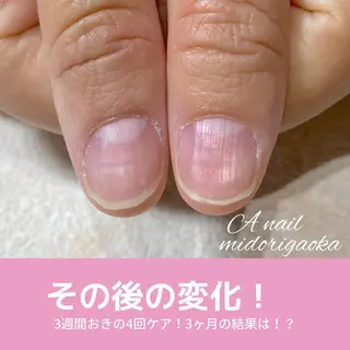 ネイル 大人可愛い高技術ネイ ル♡美爪A nailのネイルデザイン
