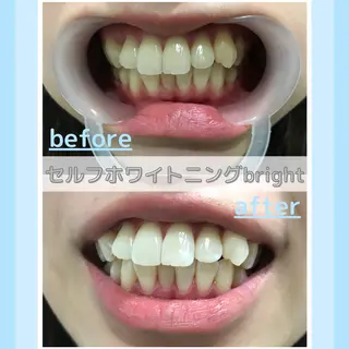 メンズ お手軽ホワイトニングsalon mina所属・武元 奈津美のエステ・リラクイメージ