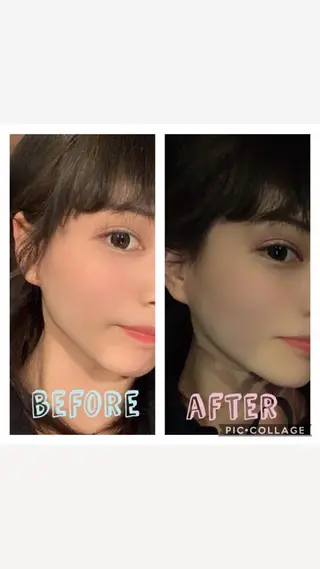 美容鍼灸サロン LOMIHARIのエステ・リラクイメージ