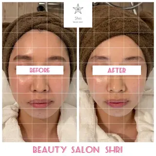 salon Lewis Addict所属・ルイスアディクト 名駅店のエステ・リラクイメージ