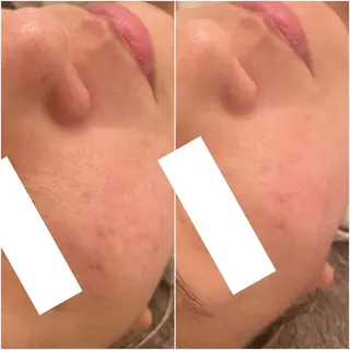 ✨美肌水光✨ アトリエリュバンのエステ・リラクイメージ