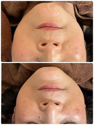 FLEUR大阪・整体 ・ハイフ・痩身・小顔のエステ・リラクイメージ