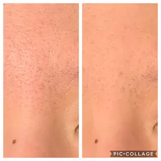 癒し腸もみサロン シャユーム　ゆきなのエステ・リラクイメージ