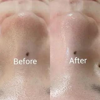 フェイシャルエステ ラトゥール伊深のエステ・リラクイメージ