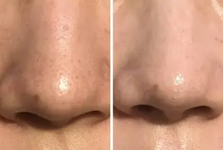 最速小顔・肌質管理 ❣️エスポワールのエステ・リラクイメージ