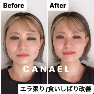 頭蓋骨から小さくする小顔&ヘッドスパ専門店 CANAEL所属・頭蓋骨から小さくする 小顔&ヘッドスパ専門のエステ・リラクイメージ