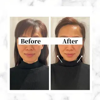 12Dハイフ💗 最強小顔のエステ・リラクイメージ