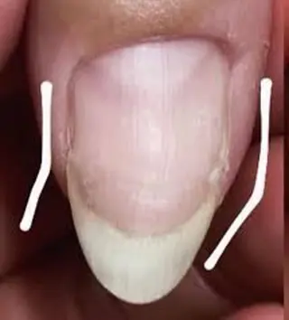 ネイル Y U K Iのネイルデザイン