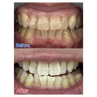 MBEAUTYSALON 千葉店・京成大久保所属・Melty 輝のその他イメージ