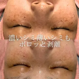 BestBelleꕤ 大阪福島/肌質改善のエステ・リラクイメージ